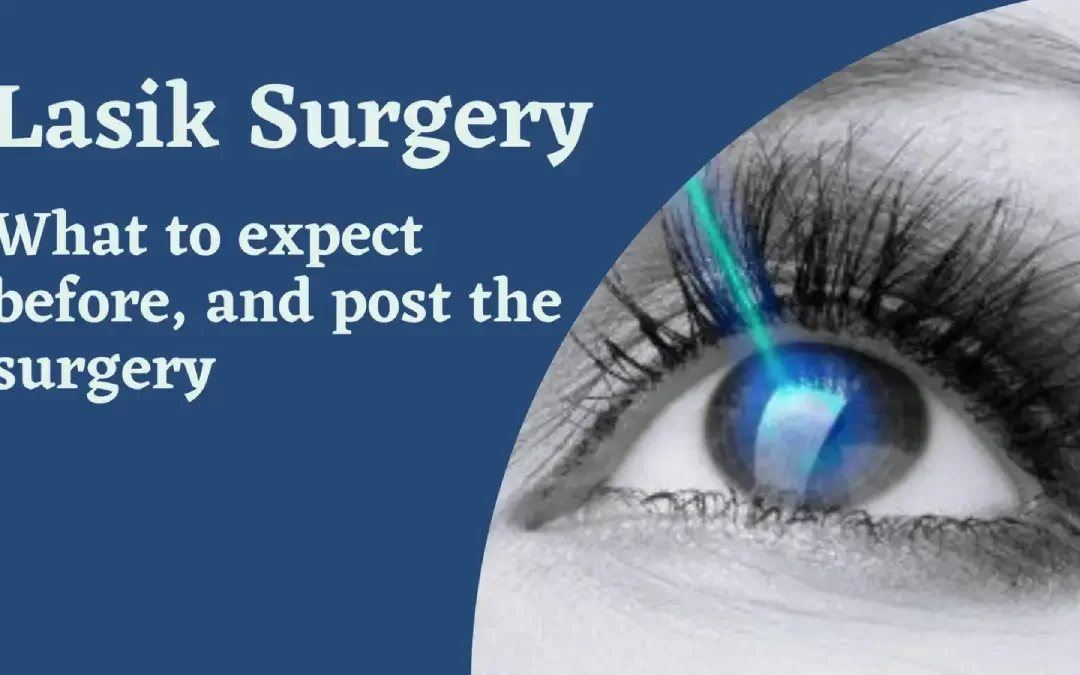 Lasik Surgery: What to expect before, and post the surgery
