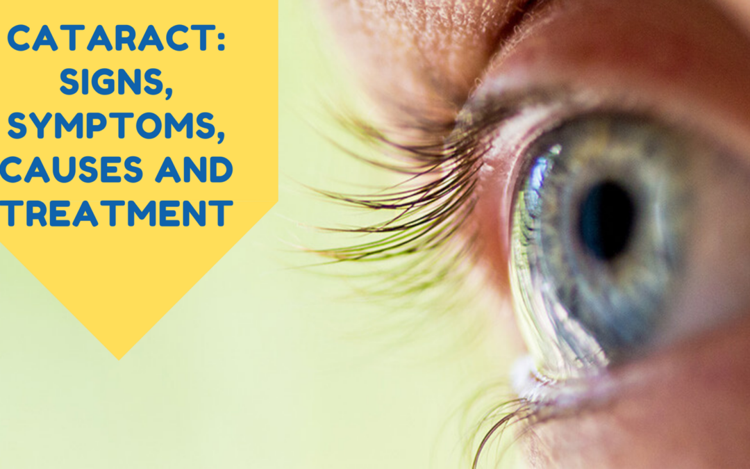 Cataract: Signs, Symptoms, Causes and Treatment