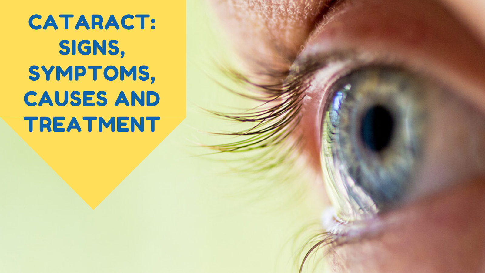 Cataract Surgery in Mumbai by Krishna Eye Center