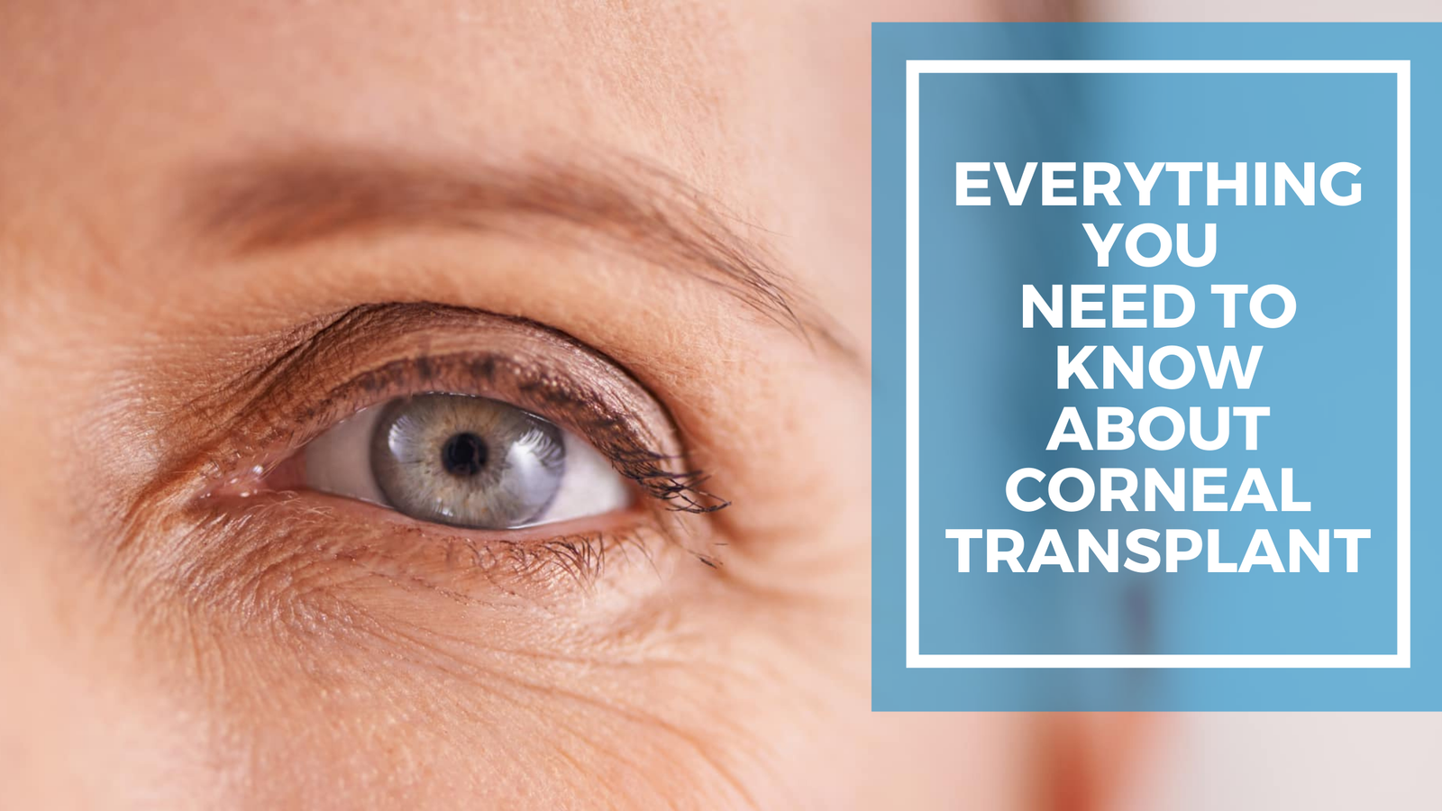 Everything you Need to know About Corneal Transplant Everything you Need to know About Corneal Transplant