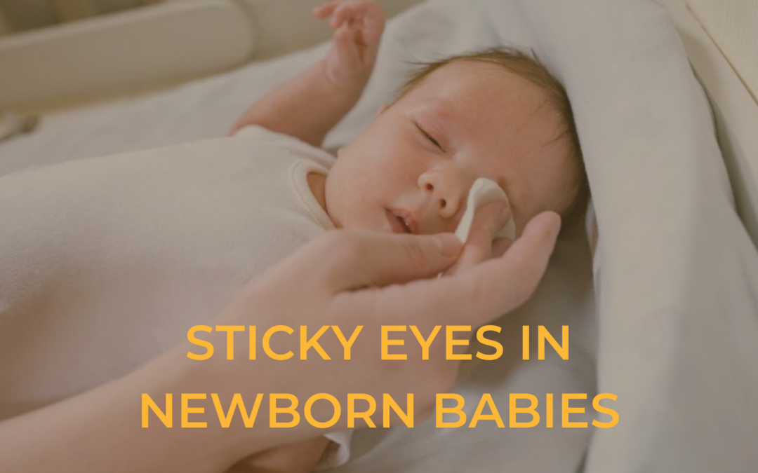 Sticky Eyes in Newborn Babies