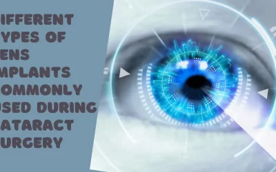 Different types of lens implants commonly used during cataract surgery