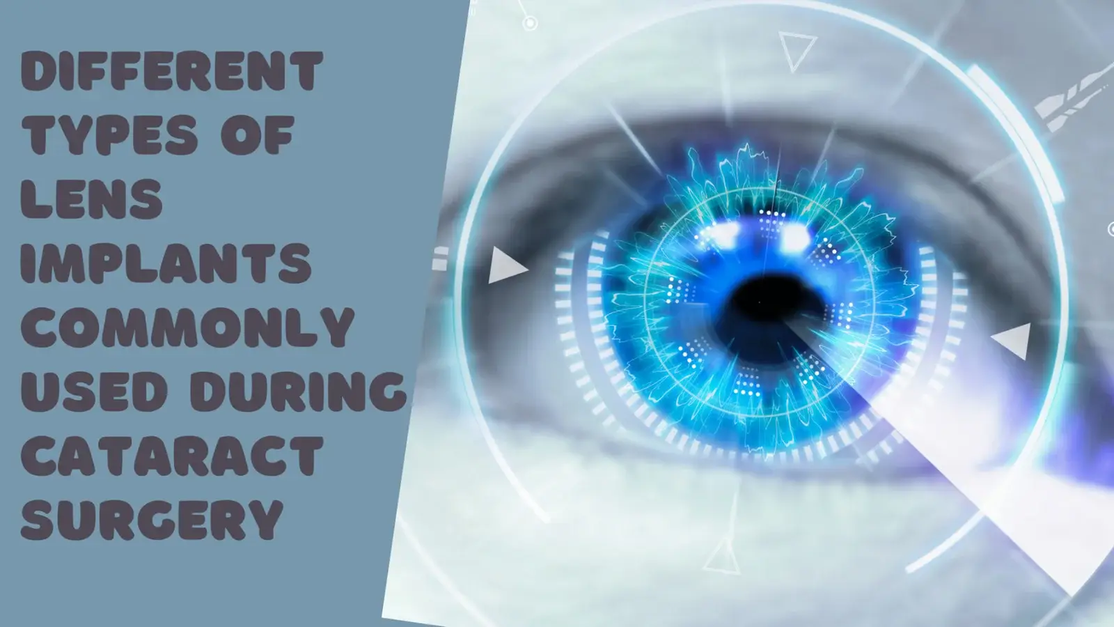 Different types of lens implants commonly used during cataract surgery Different types of lens implants commonly used during cataract surgery