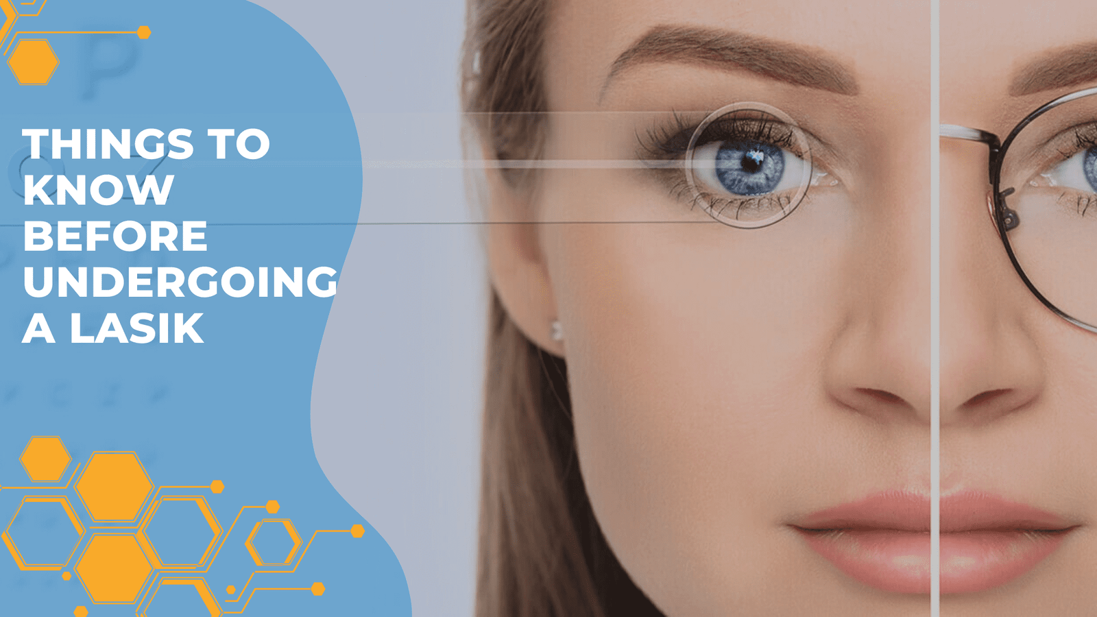 Things to know before undergoing a Lasik Eye Surgery Things to know before undergoing a Lasik Eye Surgery