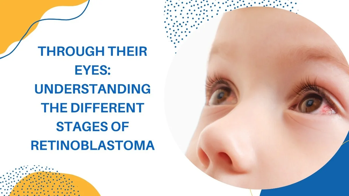 Through Their Eyes: Understanding the Different Stages of Retinoblastoma Through Their Eyes: Understanding the Different Stages of Retinoblastoma