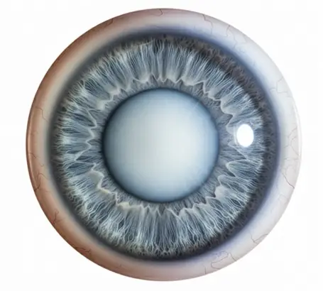 1_types_of_cataract_congenital_cataract-1