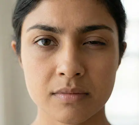 Difficulty closing the eyes completely