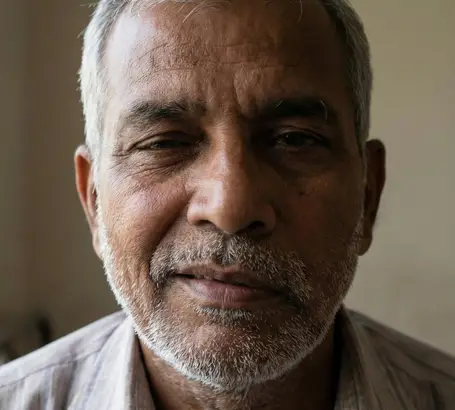Facial asymmetry due to injury