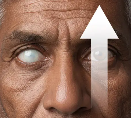 Increased-risk-of-complete-blindness