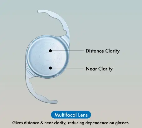 Multifocal_lens