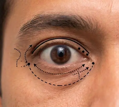 Prominent or bulging eyes