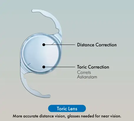 Toric_lens