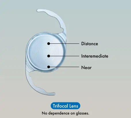 Trifocal_lens