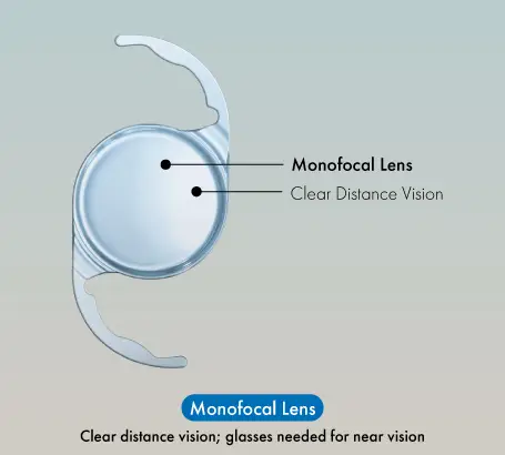 TypesOfLenses_Monofocal_lens